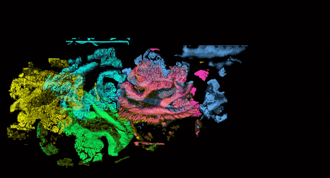 WSI segmentation